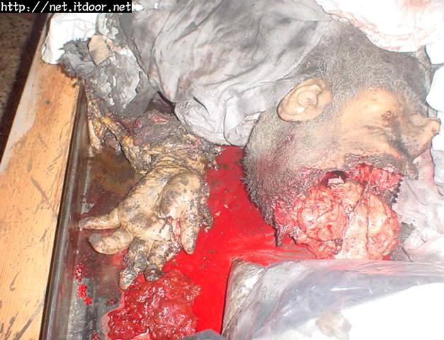 哈马斯精神领袖亚辛被炸碎的图片~!残忍的以色列人!(慎)